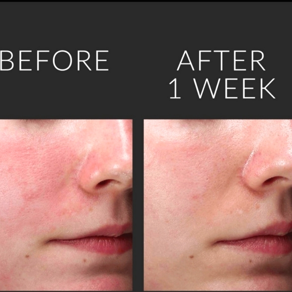 NEW IN BOX Kate Somerville Serum Soothe & Restore Active Concentrates FULL SIZE - Picture 6 of 15